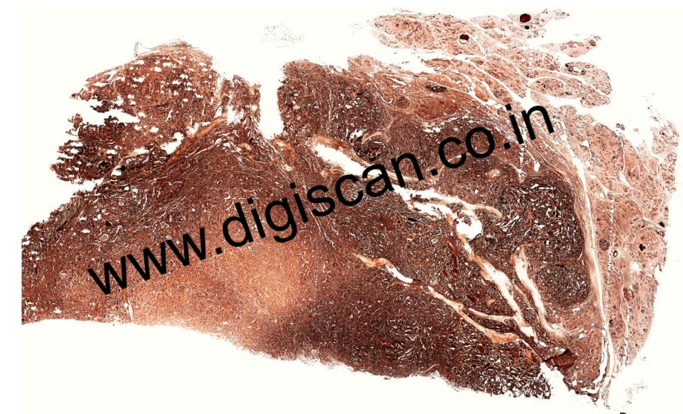 Immunohistochemistry Digital Slides Set (IHC Markers & Cases)